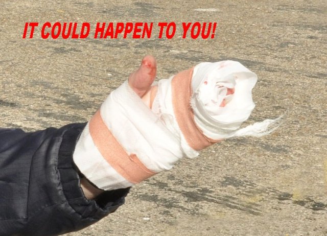 It could happen to you